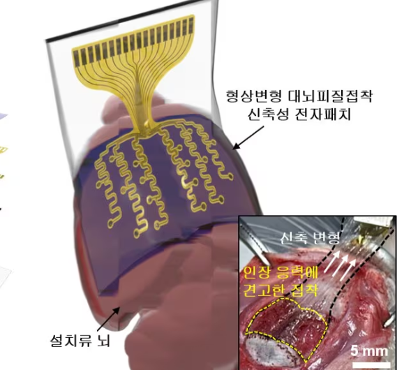 뇌 표면 밀착하는 신축성 전자패치 개발